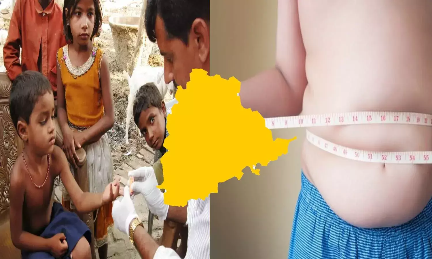 Health Survey: Anemia, obesity on the rise, neonatal mortality rate drops in Telangana
