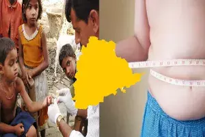 Health Survey: Anemia, obesity on the rise, neonatal mortality rate drops in Telangana Health Survey: Anemia, obesity on the rise, neonatal mortality rate drops in Telangana