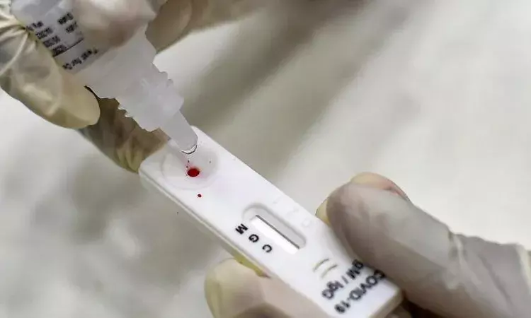 Andhra Pradesh govt reduces the price for Rapid Antigen Tests