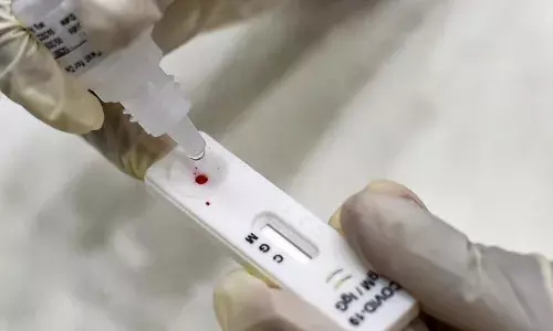 Andhra Pradesh govt reduces the price for Rapid Antigen Tests