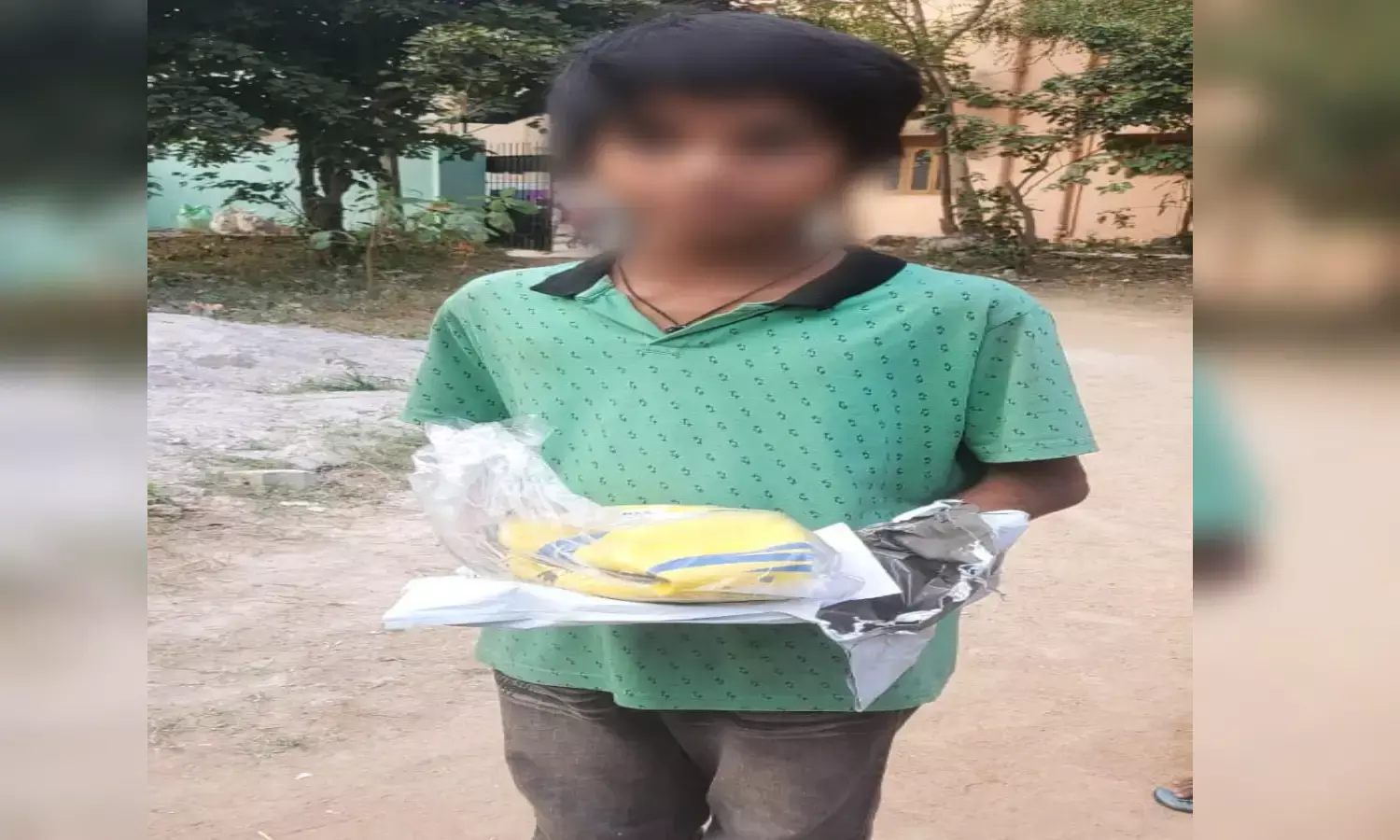 10 YO, who was set afire by father, succumbs at Gandhi hospital