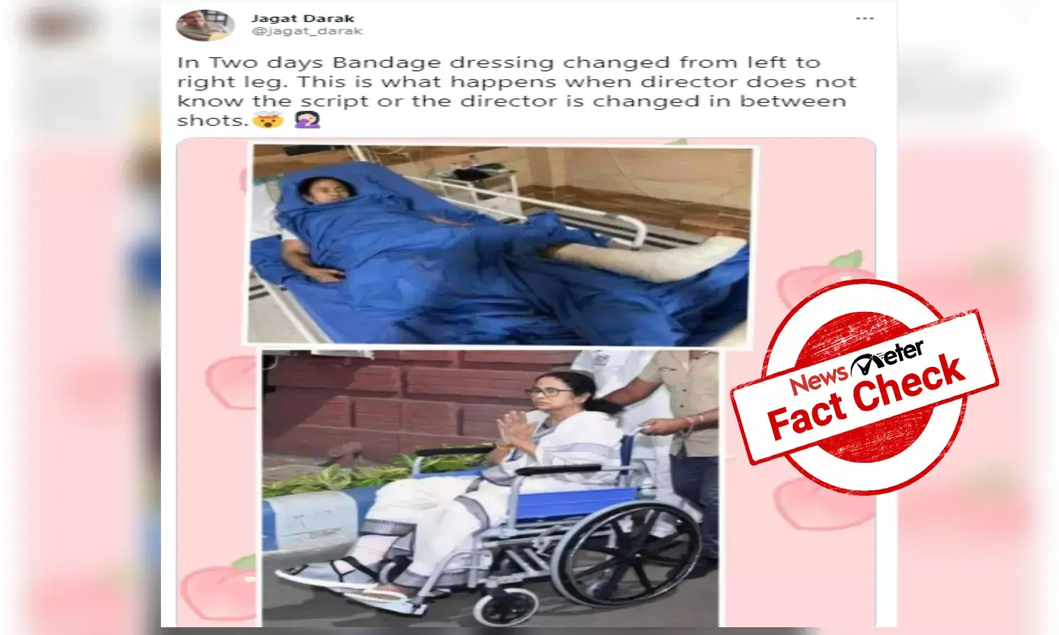Fact check:  Didis injuries are real, images are fake