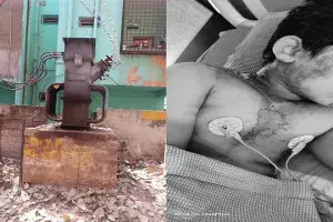 8-YO A.S Rao nagar boy sustains injuries from electric shock, KTR helps cover hospital bill 8-YO A.S Rao nagar boy sustains injuries from electric shock, KTR helps cover hospital bill