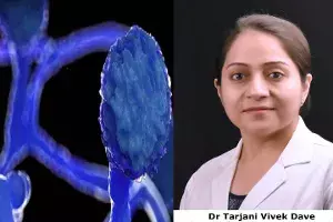Why this sudden spike in black fungus cases in COVID second wave? Why this sudden spike in black fungus cases in COVID second wave?