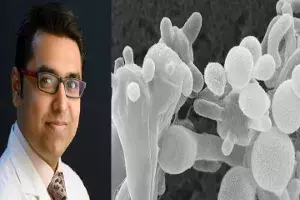 Explained: What is White Fungus, its symptoms and who are vulnerable Explained: What is White Fungus, its symptoms and who are vulnerable