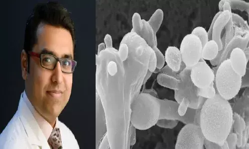 Explained: What is White Fungus, its symptoms and who are vulnerable