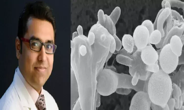 Explained: What is White Fungus, its symptoms and who are vulnerable