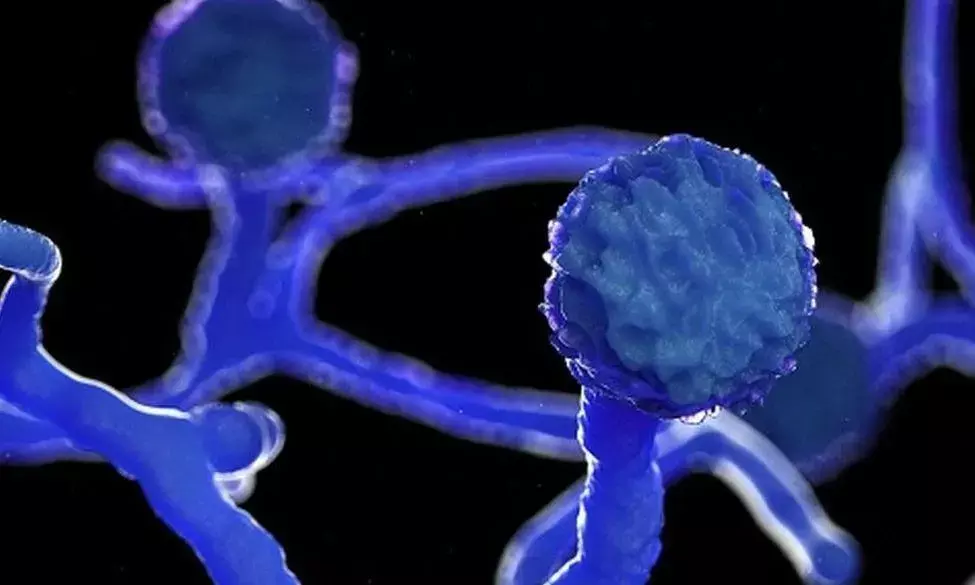 Black Fungus: Telangana at fifth position with 744 cases