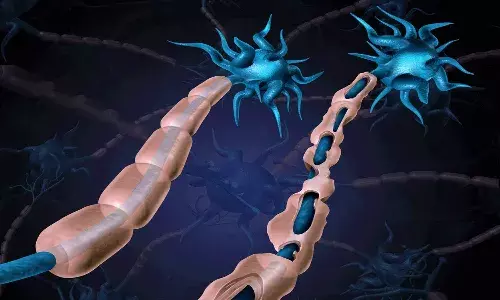 World Multiple Sclerosis Day 2021: Here is an explainer into this auto-immune disease