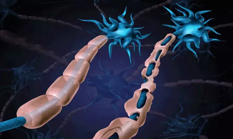 World Multiple Sclerosis Day 2021: Here is an explainer into this auto-immune disease