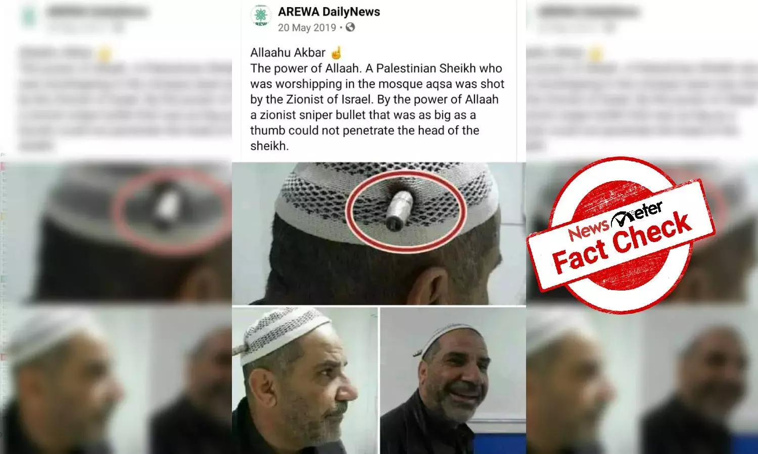 Fact Check: Viral image claiming that Israeli bullet could not penetrate Palestinian mans head is false