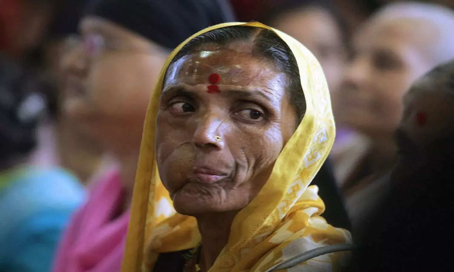 Fallout of COVID 19: Cancer management severely hit, patient flow drop by 54%