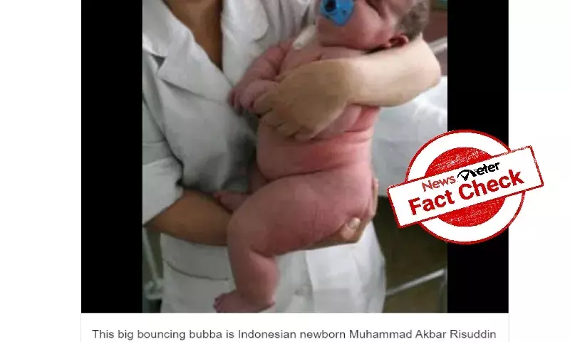 `Heaviest baby seen in viral image is Siberias Nadia, not Indonesias Risuddin