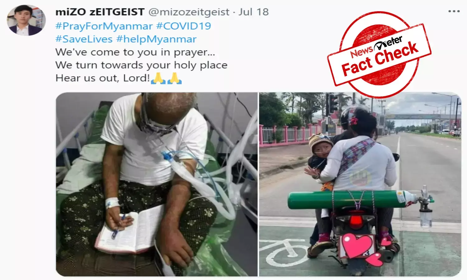 FACT CHECK: Baby suffers from respiratory defect, not COVID; he is from Thailand, not Myanmar