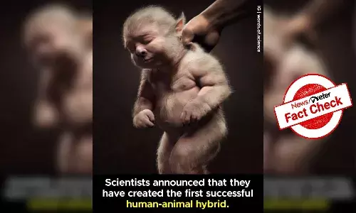 Fact Check: Baby in viral image is not human-animal hybrid