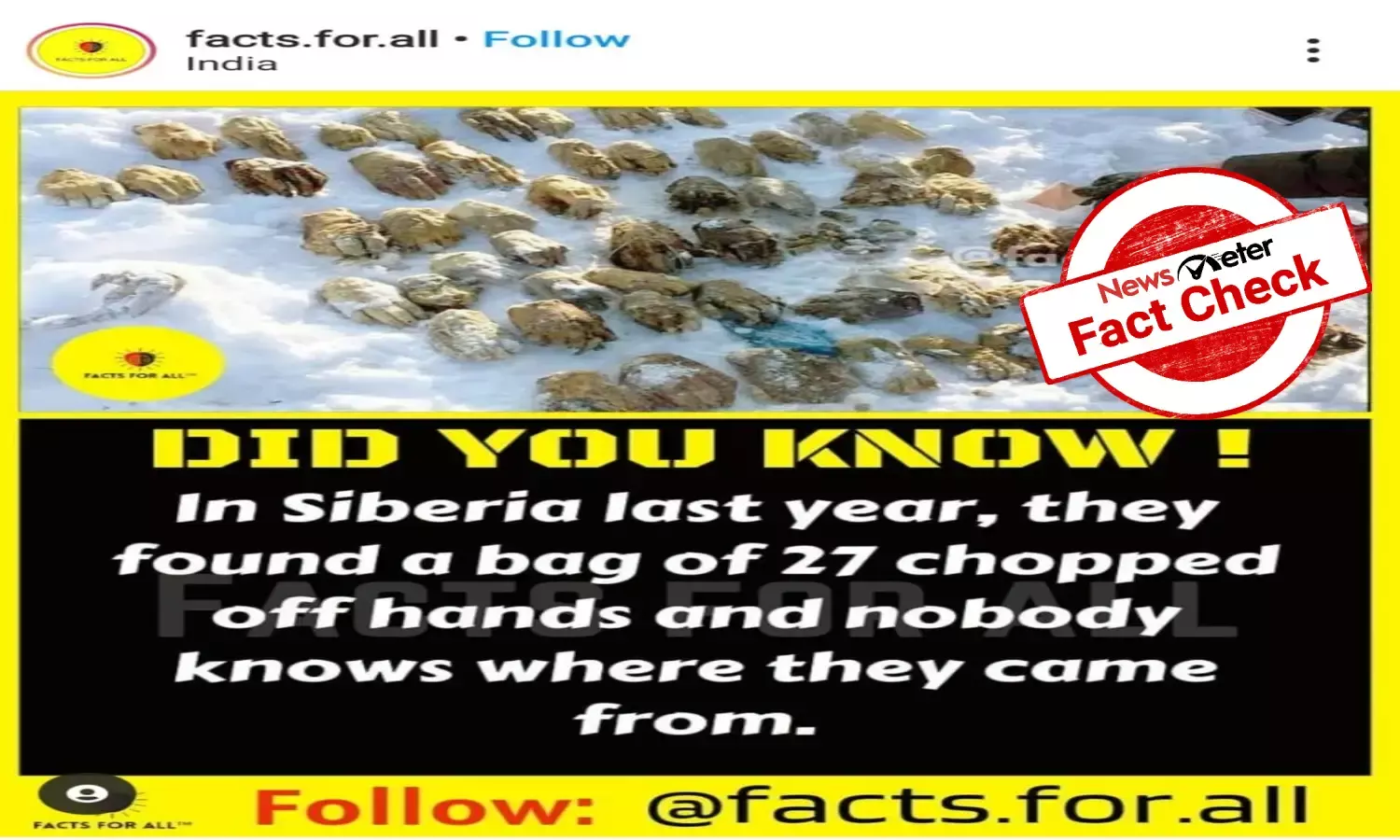 Fact Check: Viral post claiming 27 pairs of hands were found in Siberia in 2020 is false