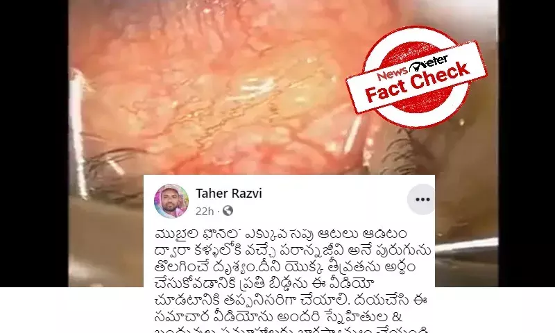 Fact Check: Excessive use of phones is unhealthy but does not cause eye worms