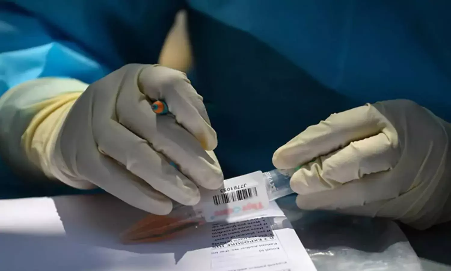 COVID 19: Telangana reports 339 fresh COVID cases, two new deaths on Friday