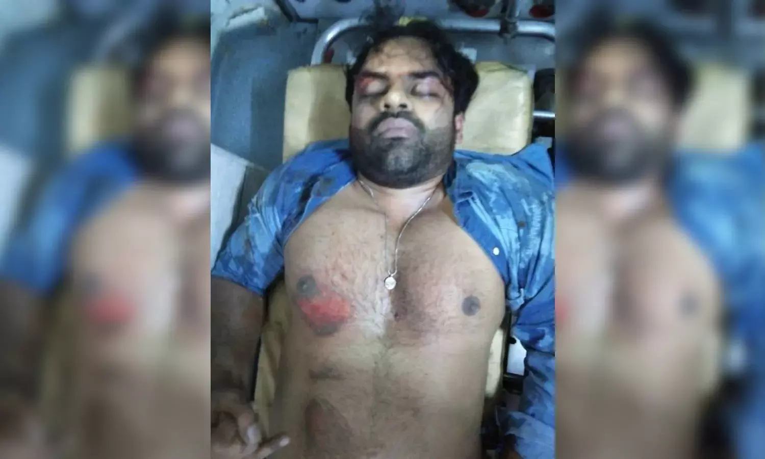 Tollywood actor Sai Dharam Tej injured in an  accident