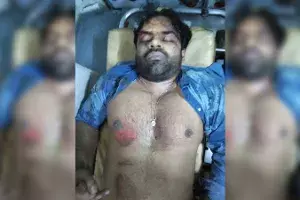 Tollywood actor Sai Dharam Tej injured in an accident Tollywood actor Sai Dharam Tej injured in an accident