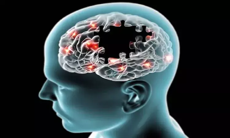 Explained: Of Alzheimers disease, prevention, and cure