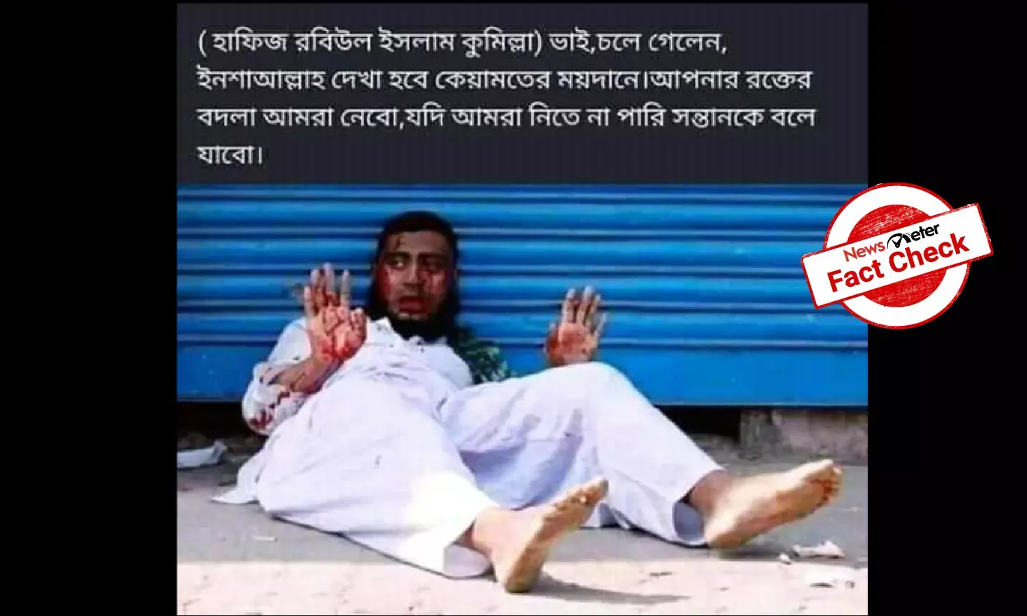 Fact Check: Old image of bleeding man linked to violence in Comilla