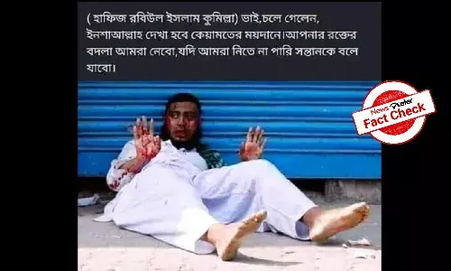 Fact Check: Old image of bleeding man linked to violence in Comilla