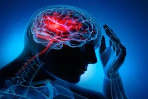 #StopTheStroke: Young people dying of undetected stroke becoming a major concern #StopTheStroke: Young people dying of undetected stroke becoming a major concern