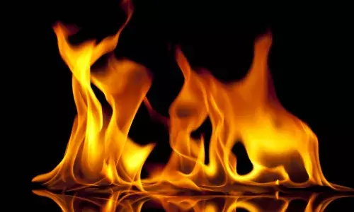 TS youth who set Vizag girl ablaze succumbs to burns