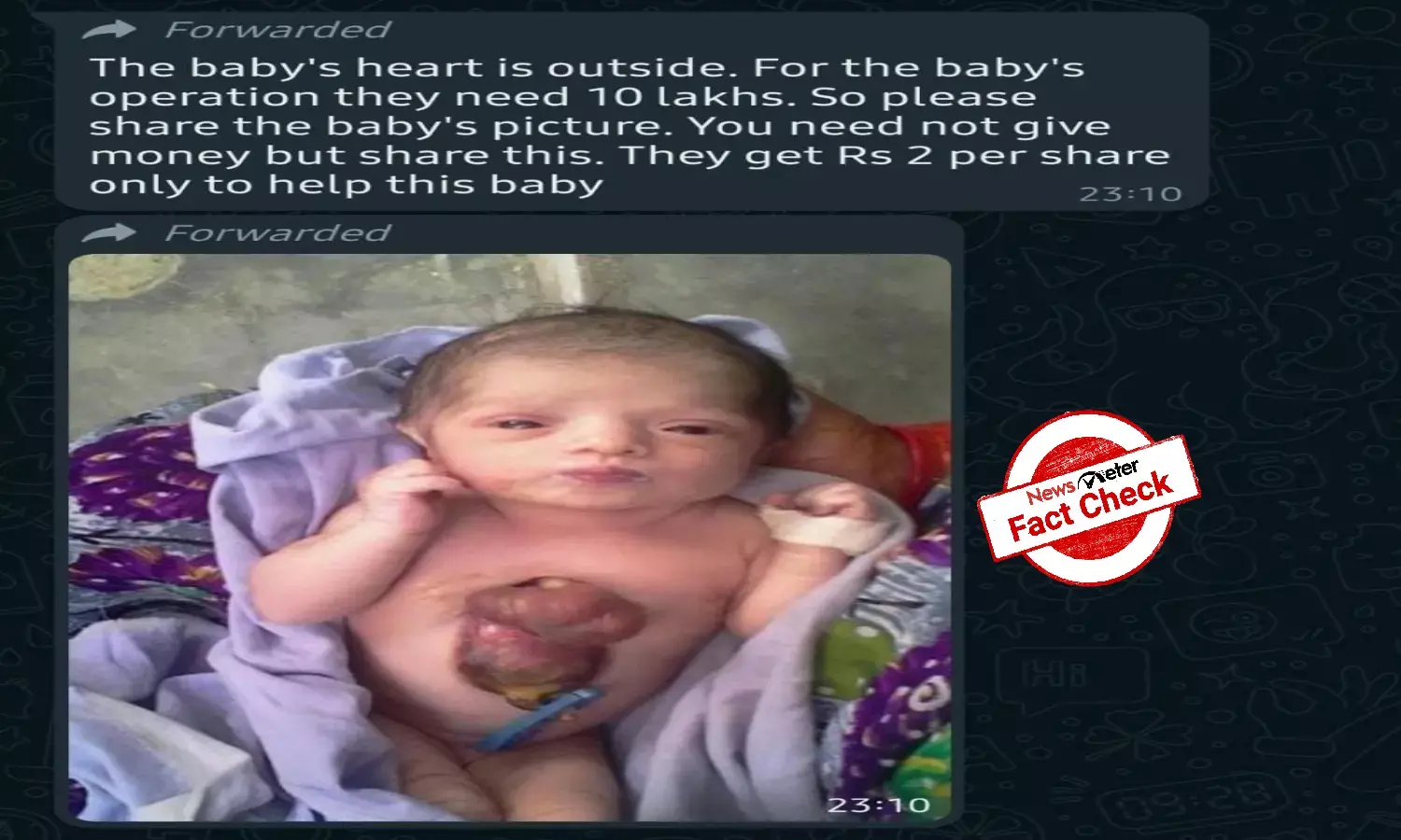 Fact Check: Old news of baby girl born with rare congenital heart disease shared as recent
