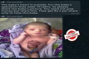 Fact Check: Old news of baby girl born with rare congenital heart disease shared as recent Fact Check: Old news of baby girl born with rare congenital heart disease shared as recent