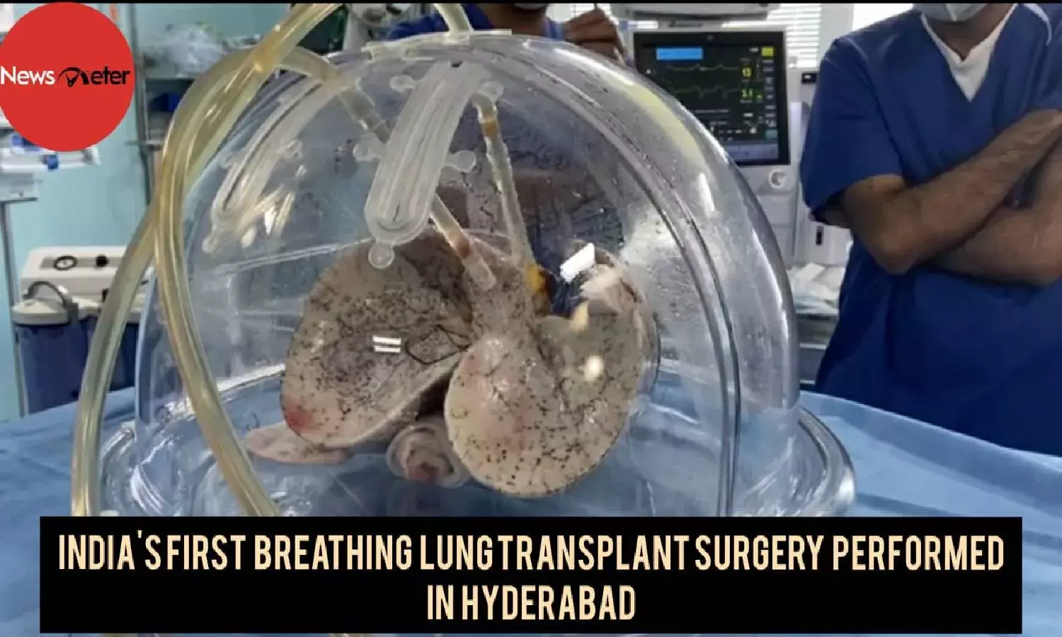 Indias first breathing lung transplant surgery performed in Hyderabad