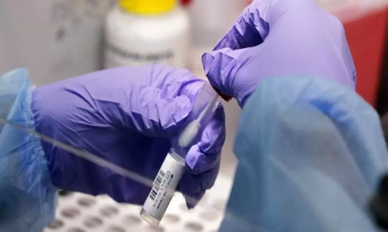 Four more omicron cases in AP, one local transmission