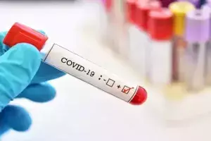 Vizag, Chittoor continue to report highest COVID-19 cases in AP Vizag, Chittoor continue to report highest COVID-19 cases in AP
