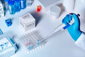 What is Ct value and how does it determine your COVID-19 test? What is Ct value and how does it determine your COVID-19 test?