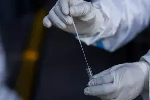 No need to test all contacts of confirmed COVID-19 cases: ICMR No need to test all contacts of confirmed COVID-19 cases: ICMR
