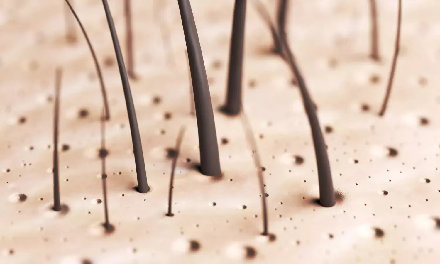 Premature Hair Loss: 10 Reasons for Hair Fall at Young Age