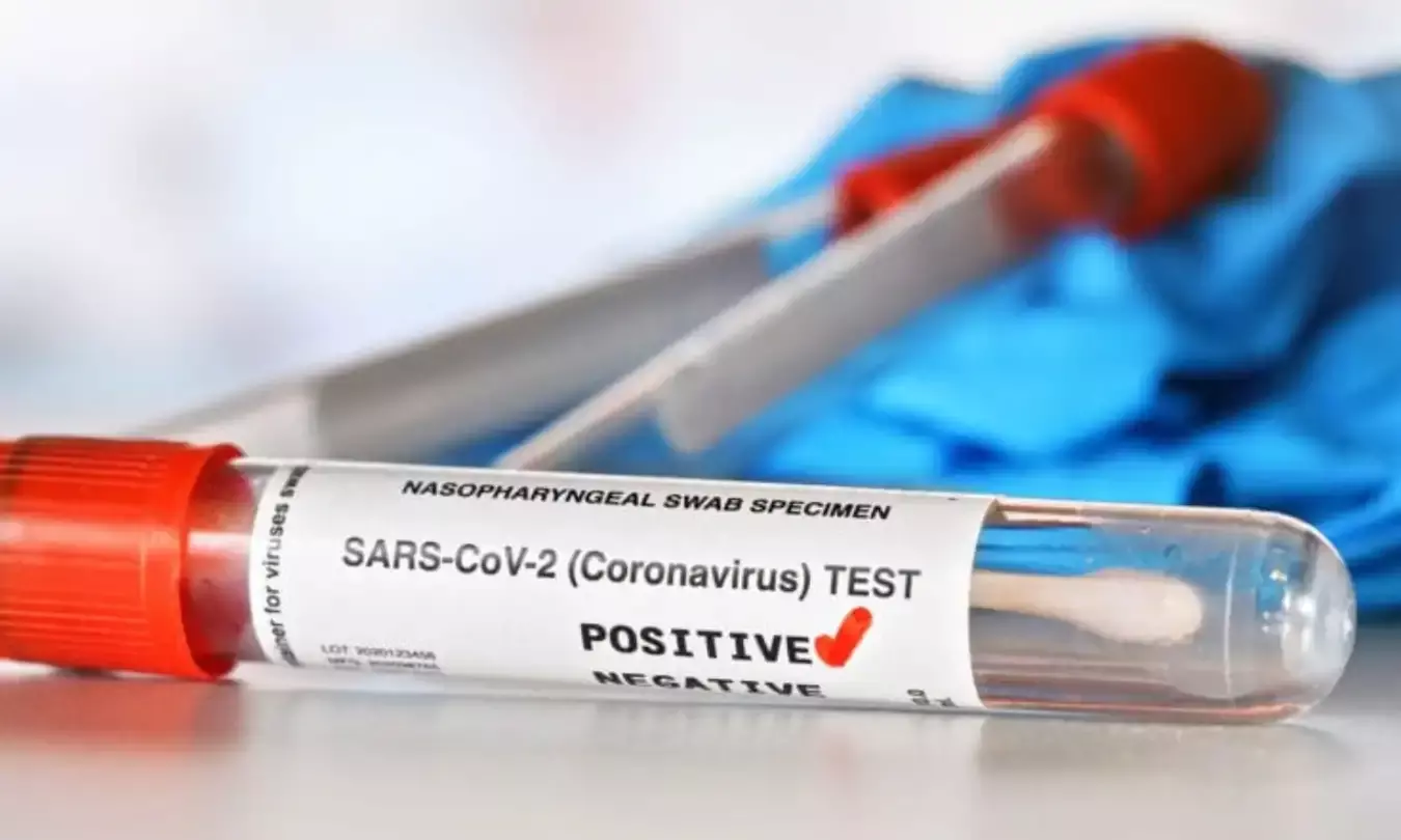 COVID-19: APs positivity rate surges to 29% in just 10 days