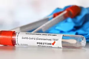 COVID-19: APs positivity rate surges to 29% in just 10 days COVID-19: APs positivity rate surges to 29% in just 10 days