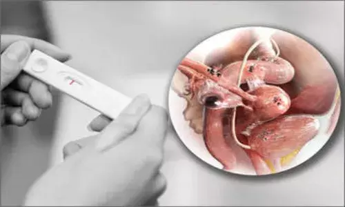 Doctor speaks: Endometriosis causes infertility in 50% of women