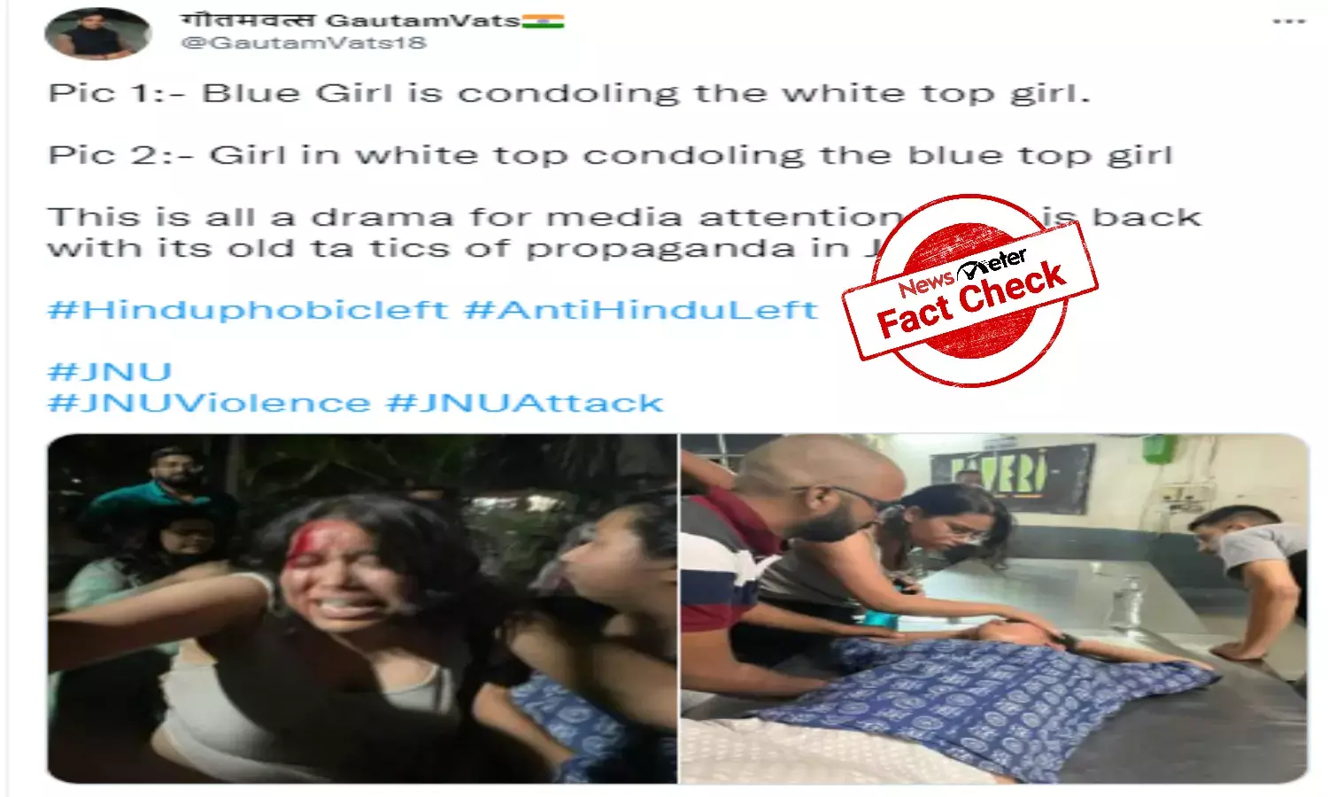 Fact Check: Did students in viral images fake injury?
