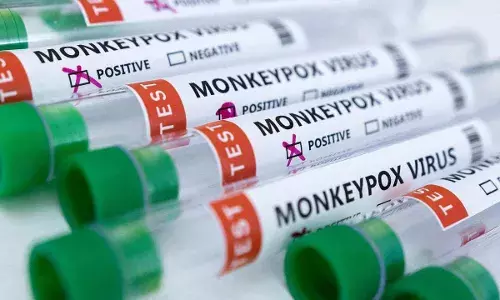Vijayawada: 2YO tests negative for Monkeypox, say test results from NIV