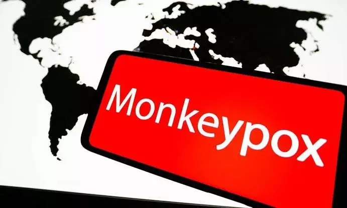 India reports first monkeypox death after UAE returnee dies in Kerala