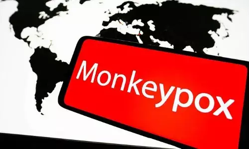 AP: Medical student suspected to have monkeypox