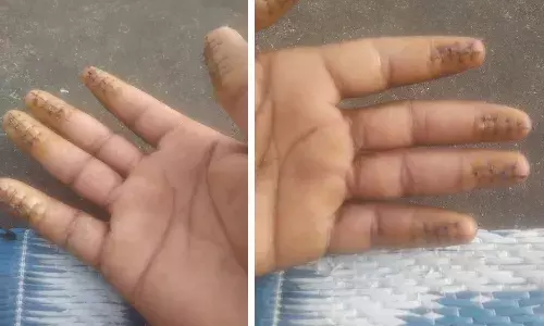 Finger Tip-Surgery: How 2 Kadapa men helped deportees re-enter Kuwait