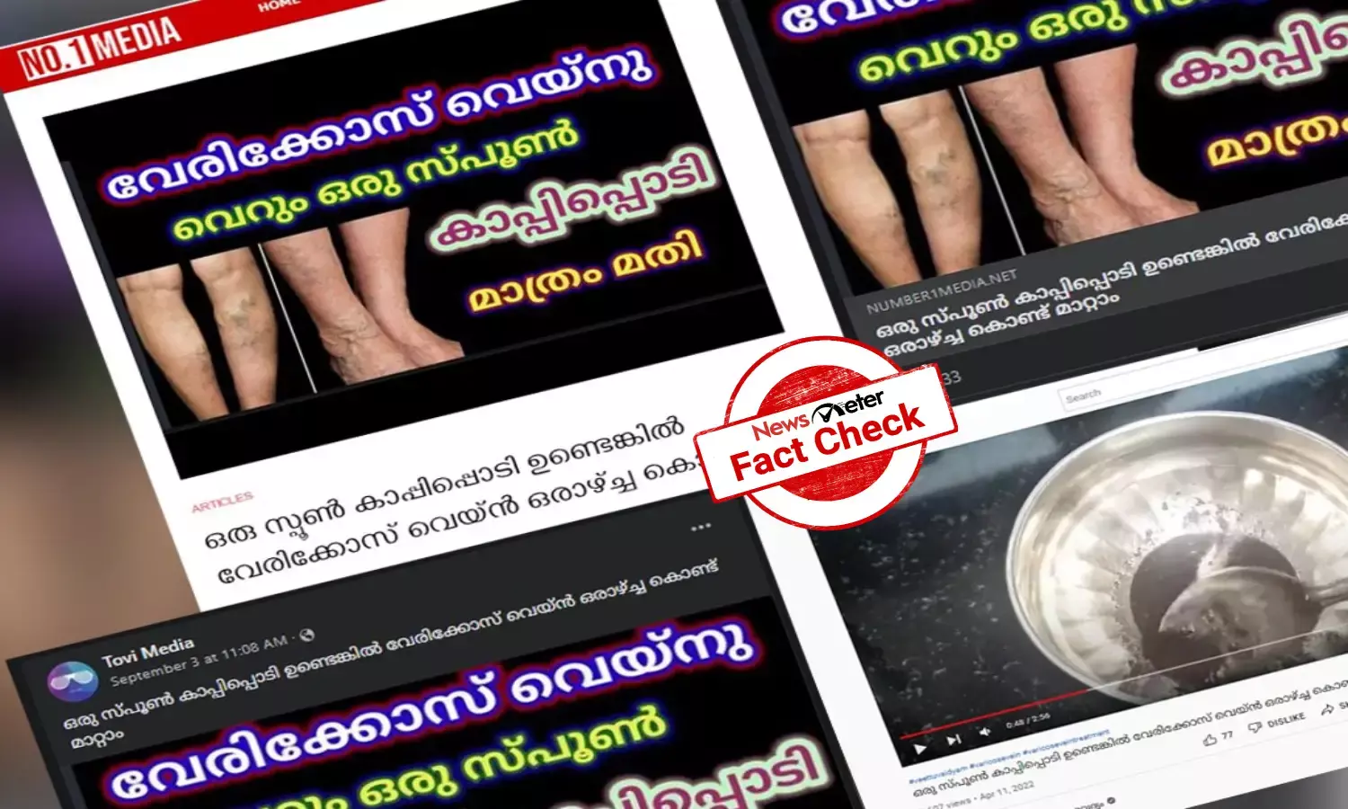 കാപ്പിപ്പൊടി വെരിക്കോസ് വെയിനിന് പരിഹാരമെന്ന്  പ്രചരണം; ശുദ്ധ അസംബന്ധമെന്ന് ആരോഗ്യ വിദഗ്ധര്‍
