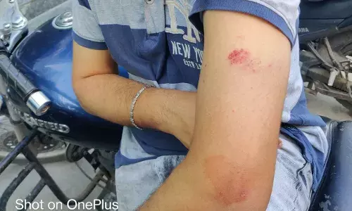 Gang barge into Kukatpally mans house, attack him; calls to police ignored