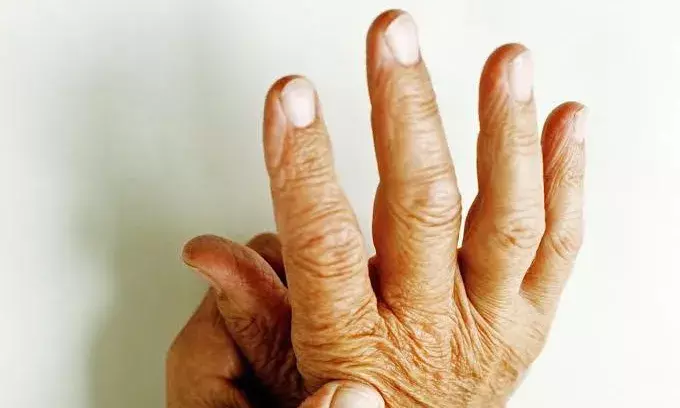 People living with arthritis have 200% greater risk of heart attack: Study