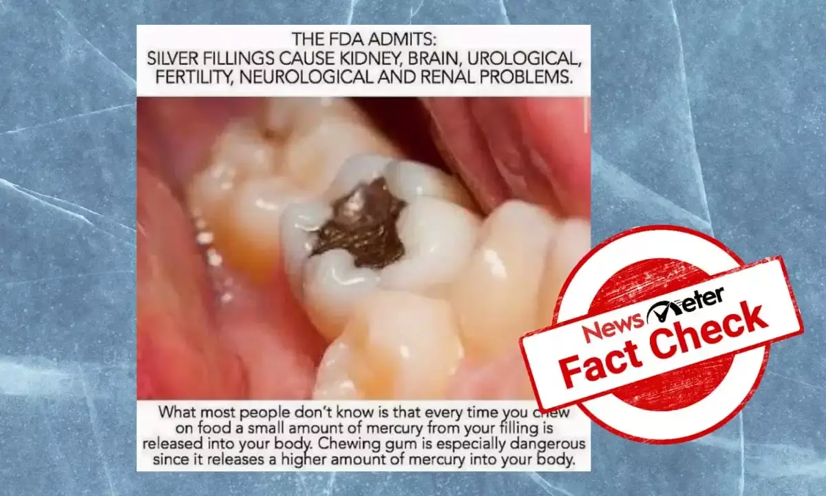 Do silver dental fillings cause serious health issues?