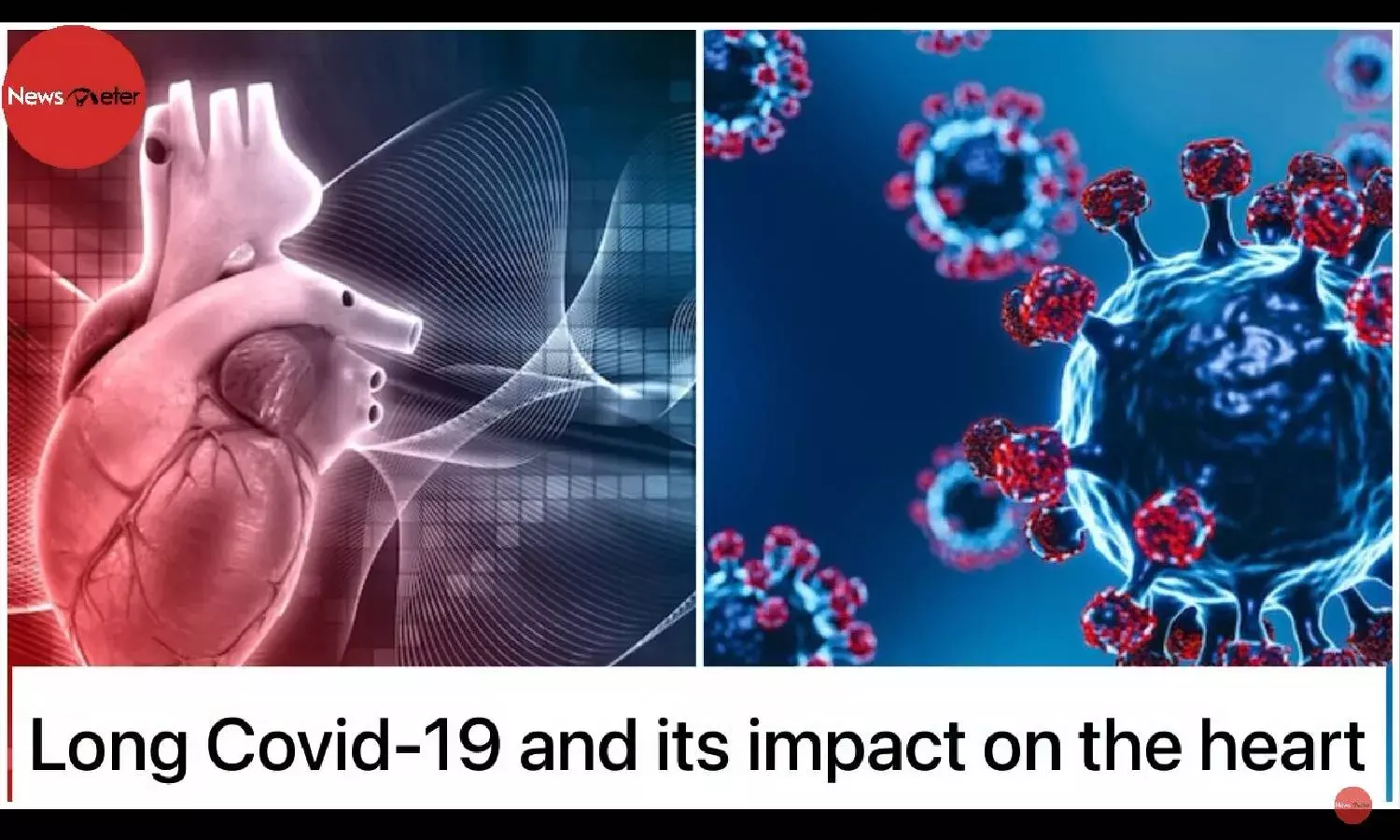Long Covid-19 and its impact on the heart